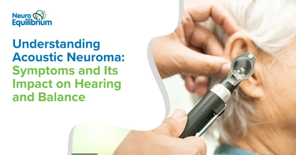 Understanding Acoustic Neuroma Symptoms and Its Impact on Hearing and Balance